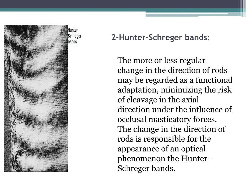 2 hunter schreger bands