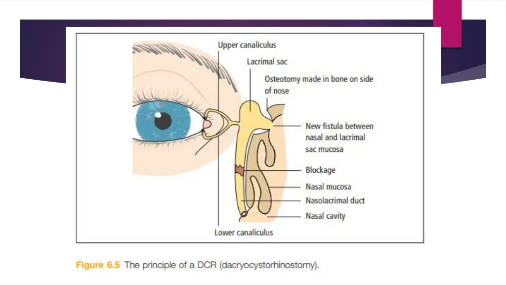 slide31