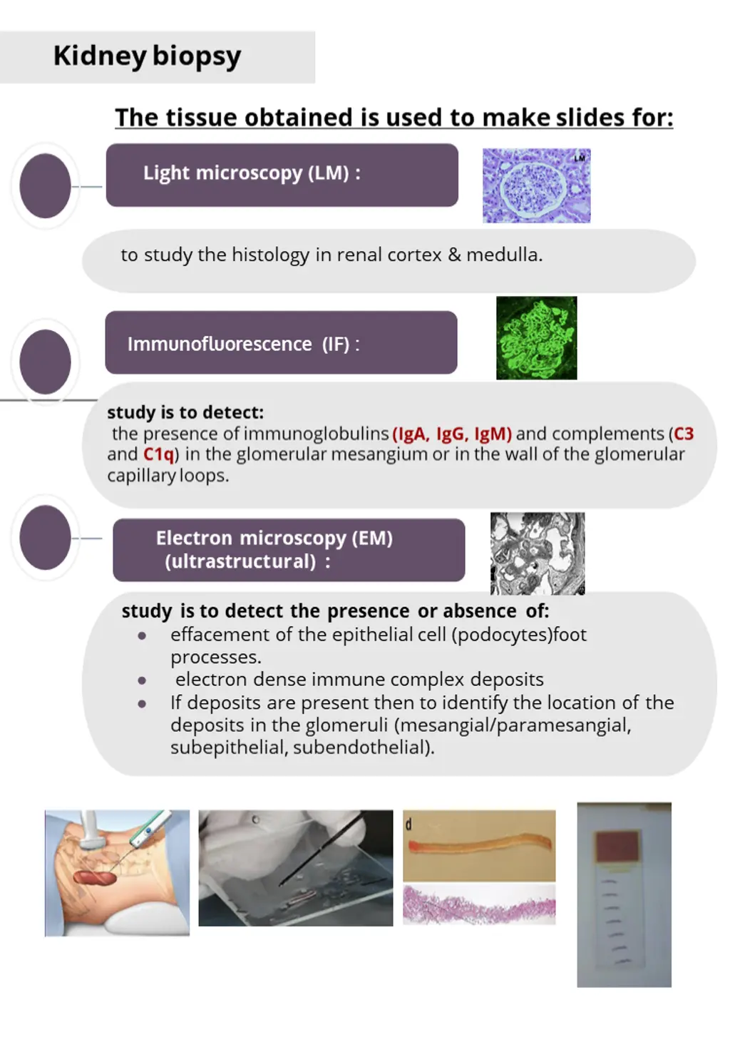 kidney biopsy