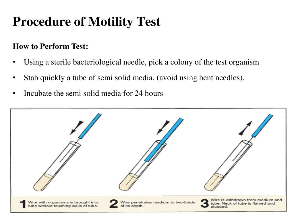 procedure of motility test