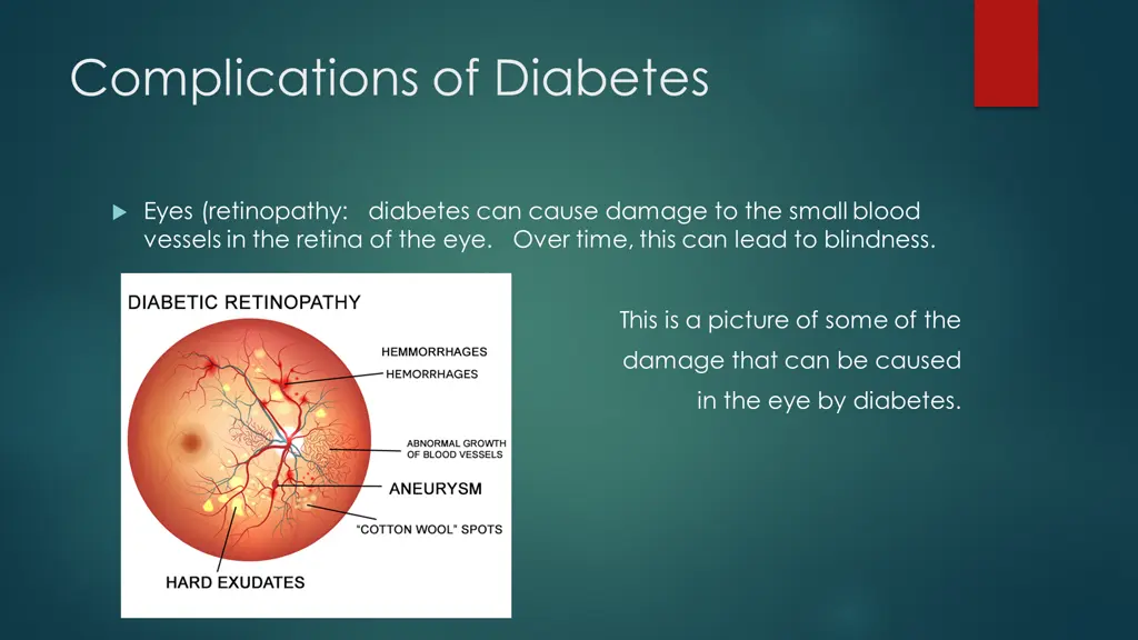 complications of diabetes