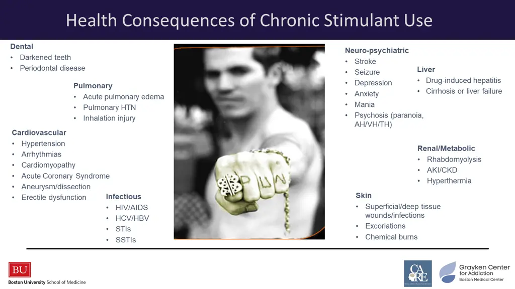 health consequences of chronic stimulant use