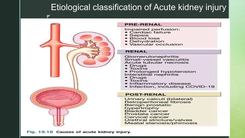 etiological classification of acute kidney injury