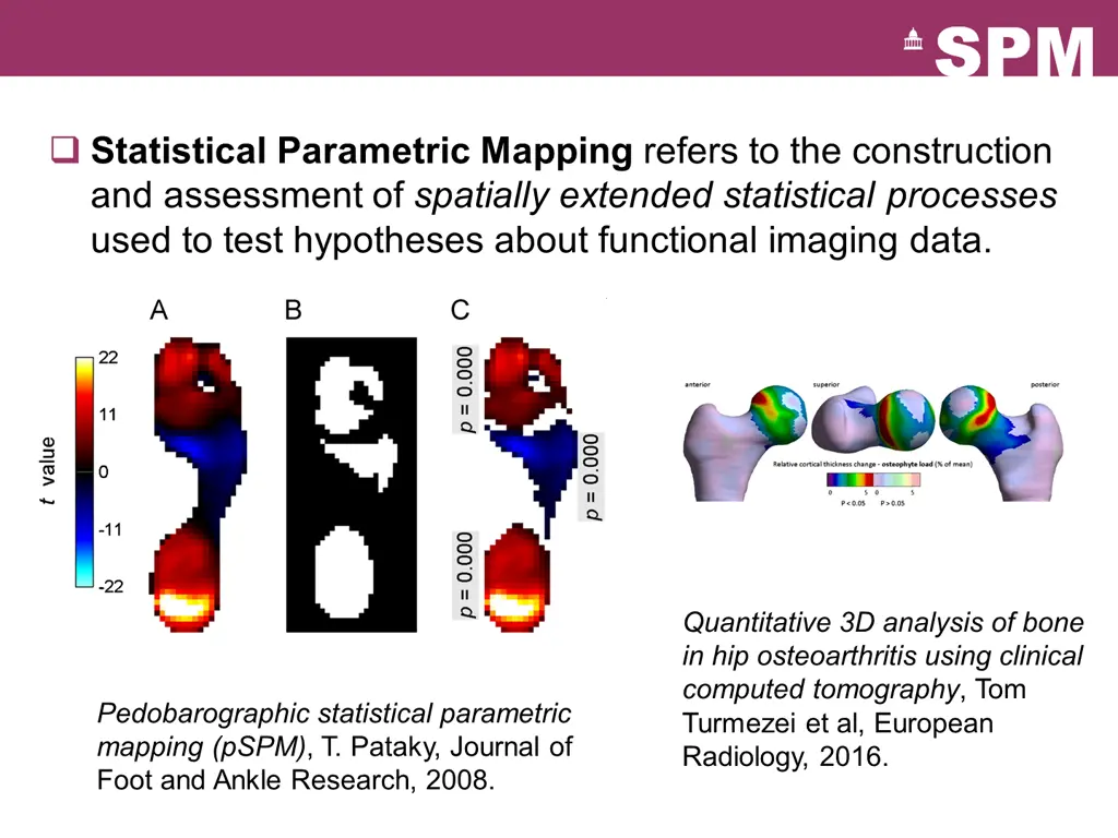 statistical parametric mapping refers