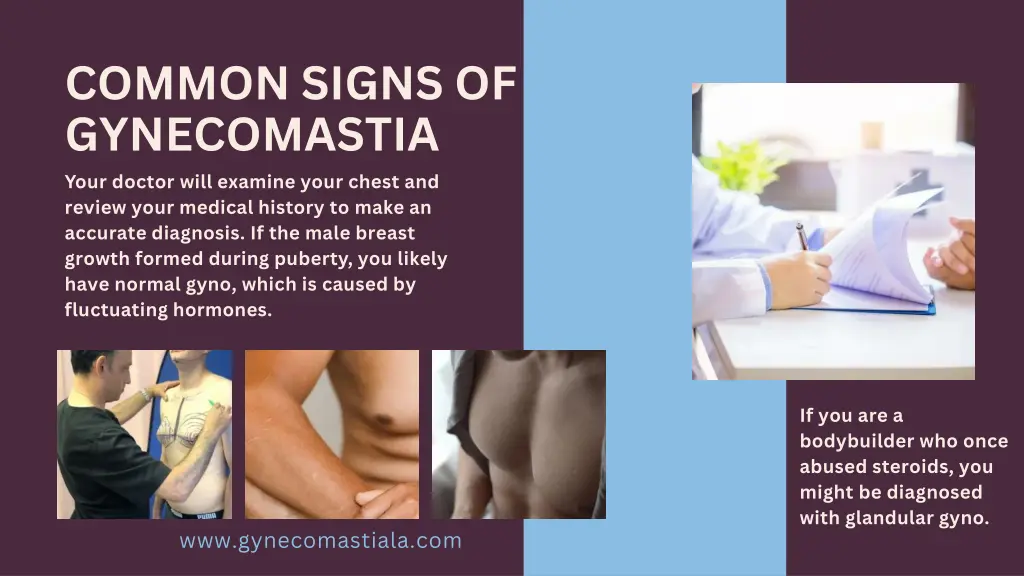 common signs of gynecomastia your doctor will