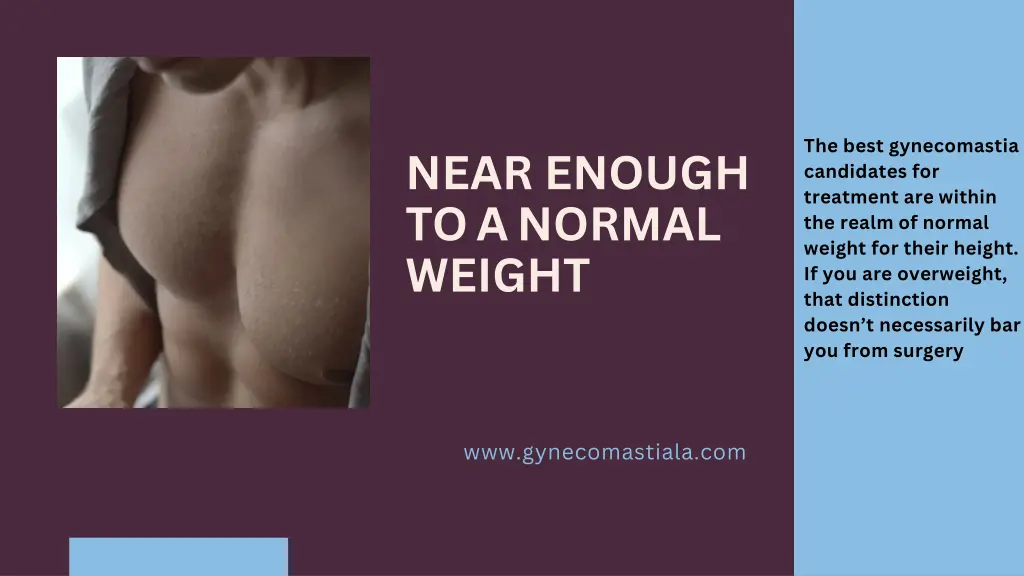 the best gynecomastia candidates for treatment