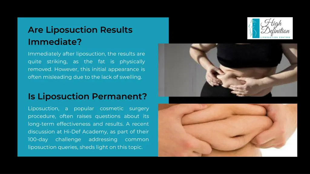 are liposuction results immediate