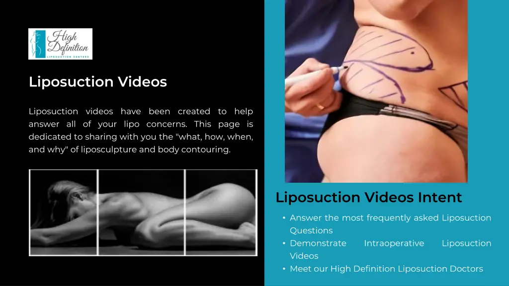 liposuction videos