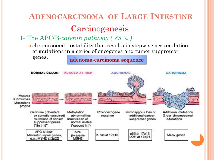 a denocarcinoma of l arge i ntestine 1