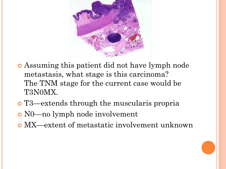 assuming this patient did not have lymph node