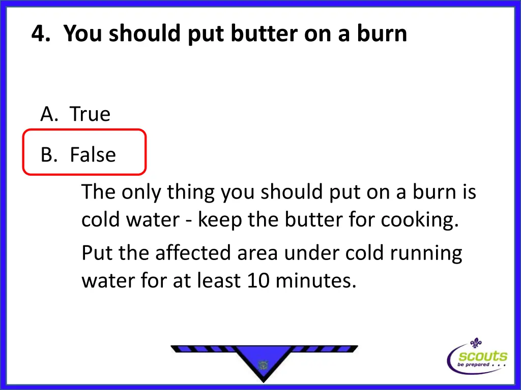 4 you should put butter on a burn