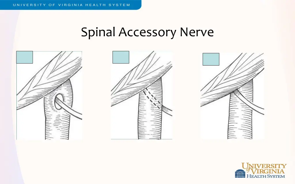 spinal accessory nerve