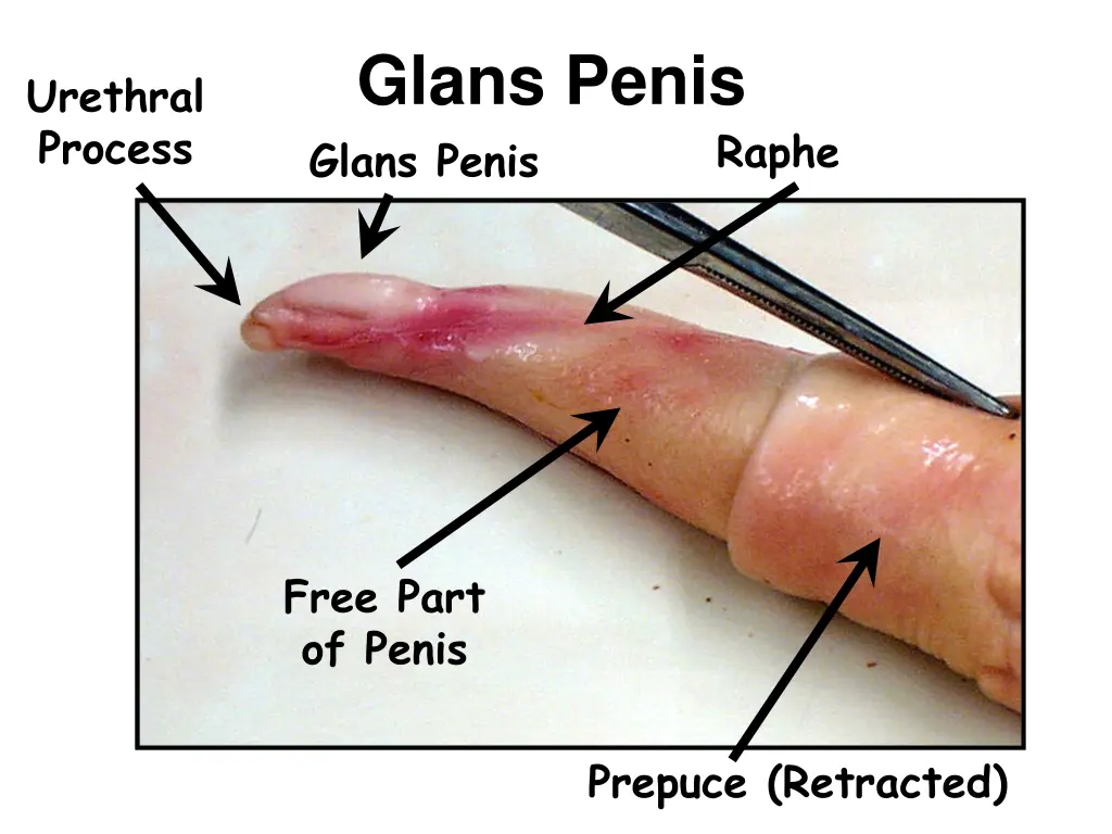 glans penis glans penis