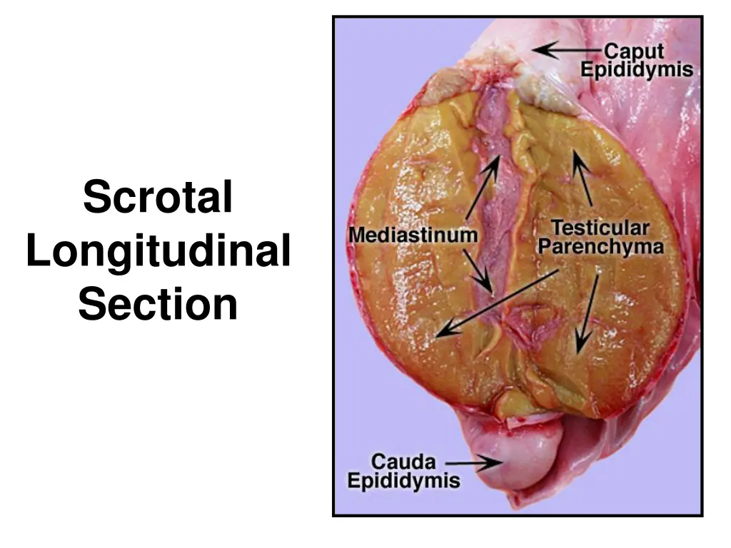 scrotal longitudinal section