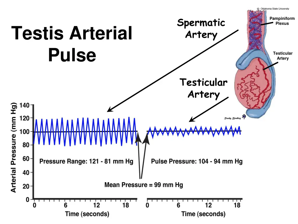 spermatic artery