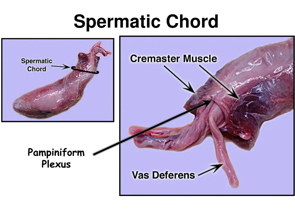 spermatic chord