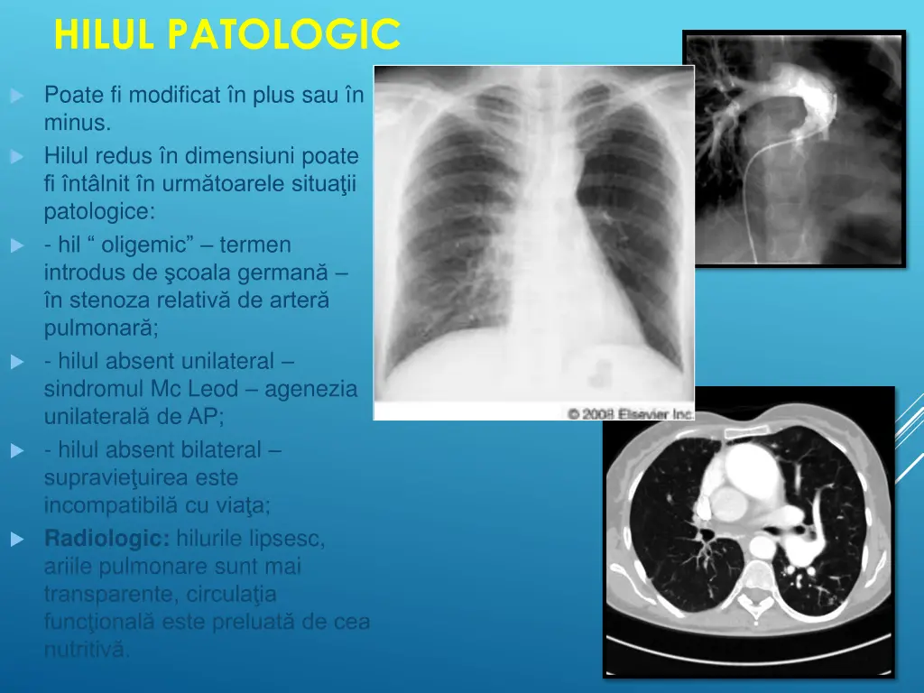 hilul patologic