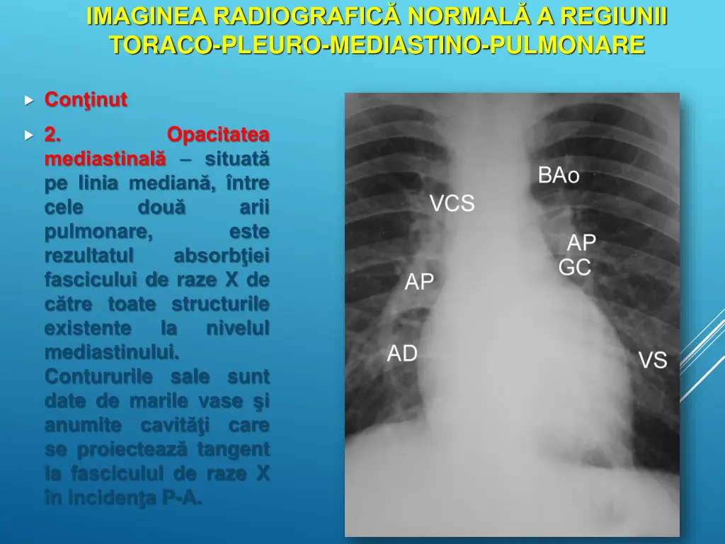 imaginea radiografic normal a regiunii toraco 10