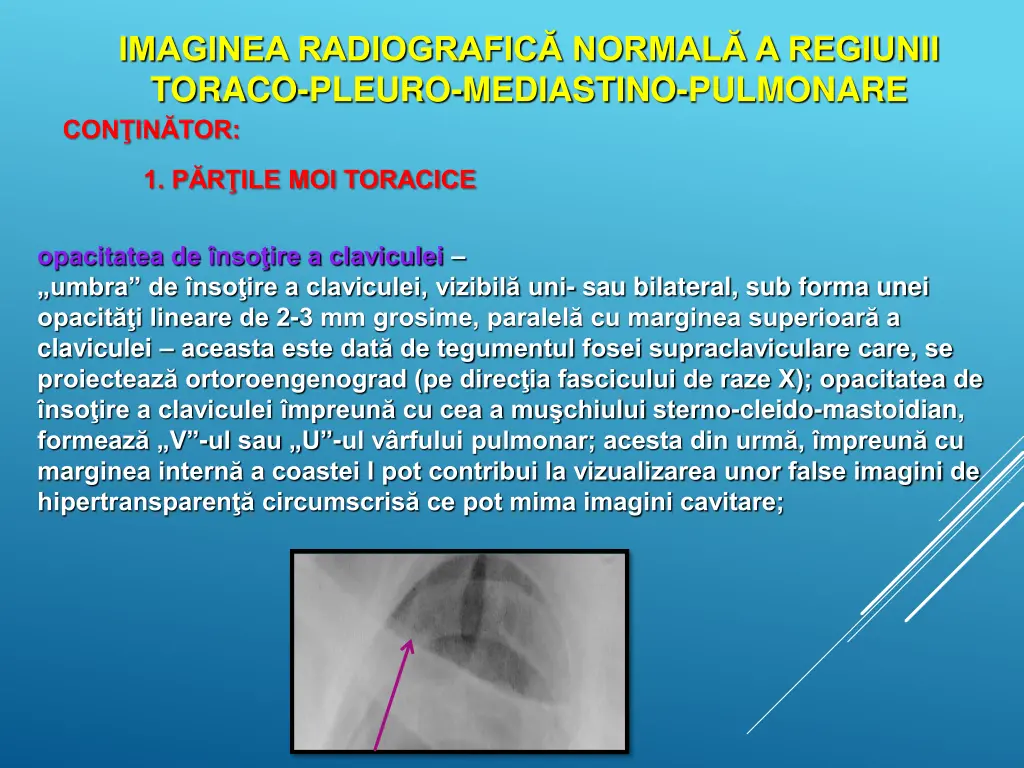 imaginea radiografic normal a regiunii toraco 3