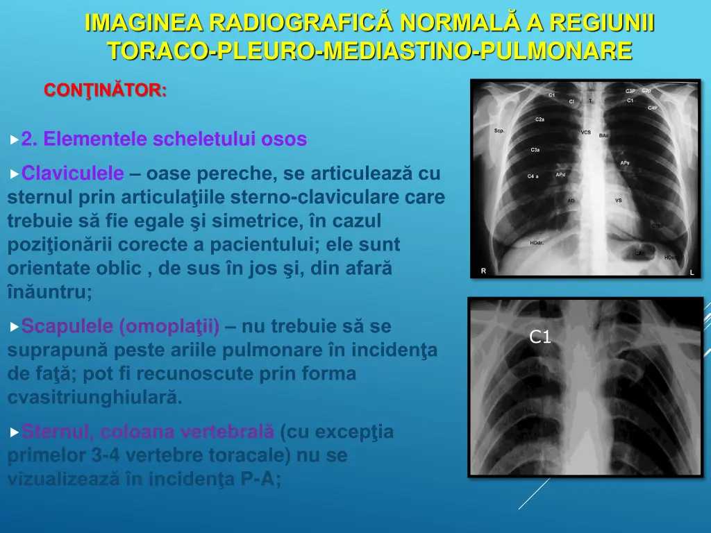 imaginea radiografic normal a regiunii toraco 5