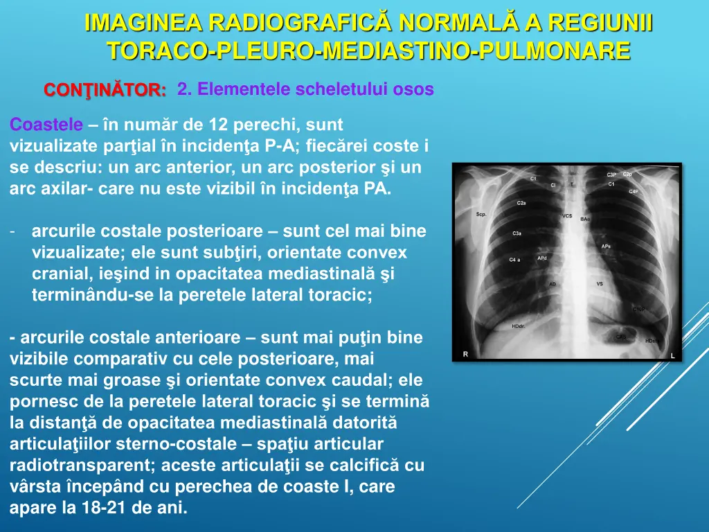 imaginea radiografic normal a regiunii toraco 6