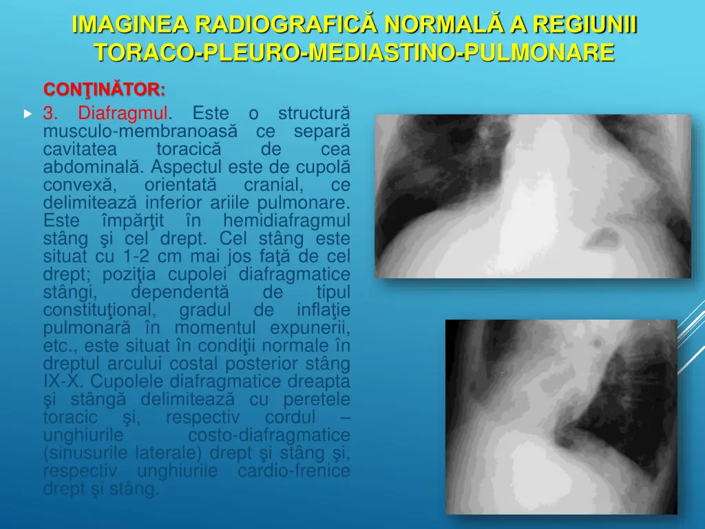 imaginea radiografic normal a regiunii toraco 8