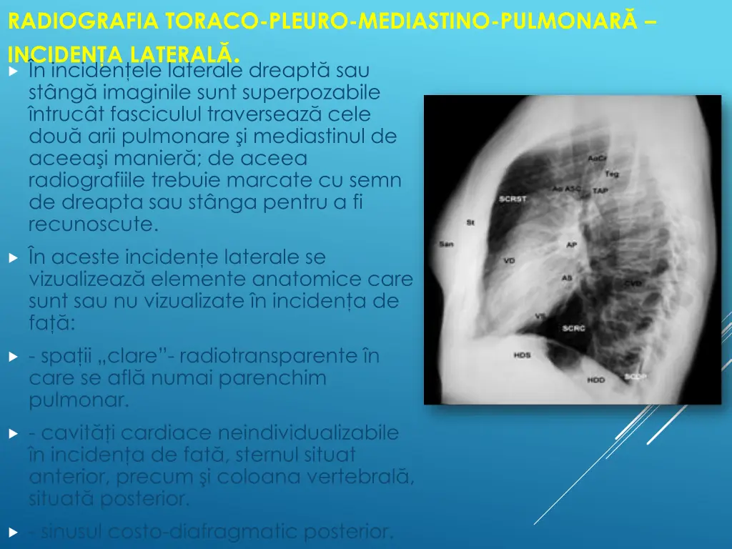 radiografia toraco pleuro mediastino pulmonar