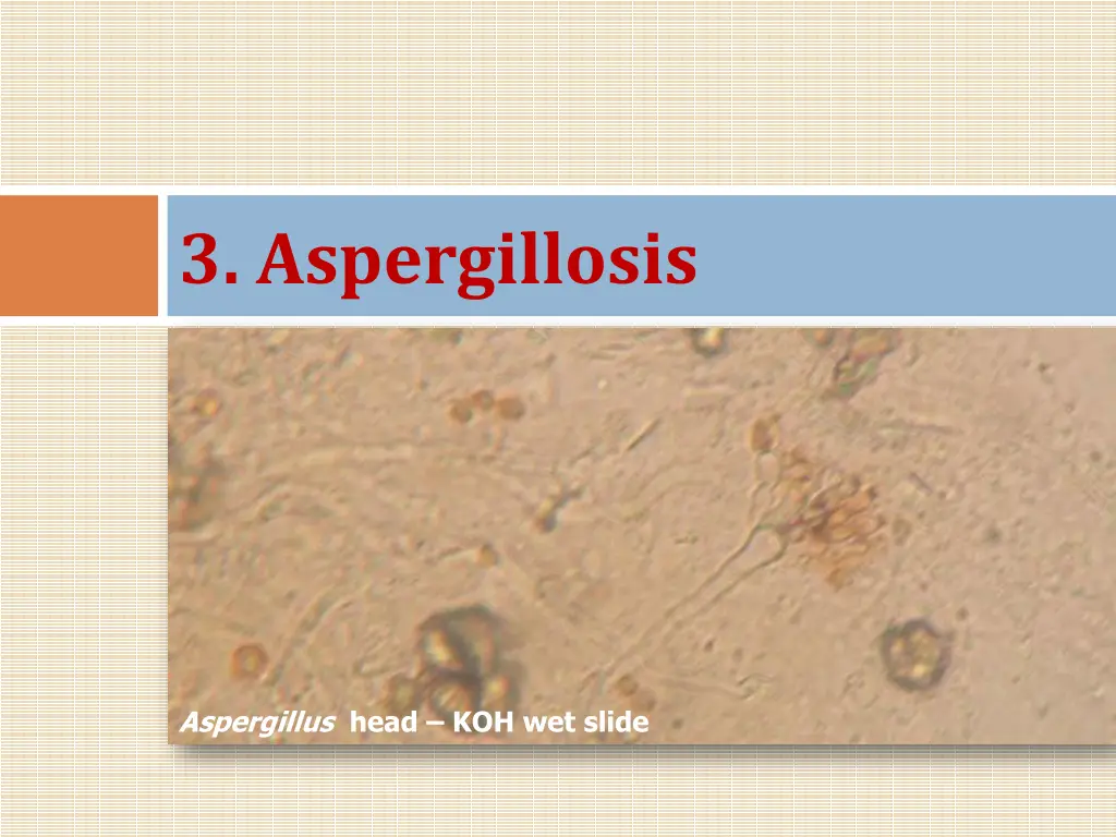 3 aspergillosis