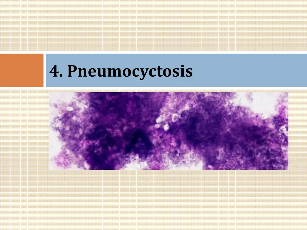 4 pneumocyctosis