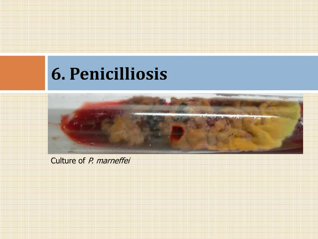 6 penicilliosis