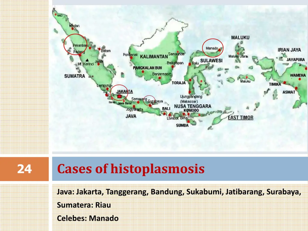 cases of histoplasmosis