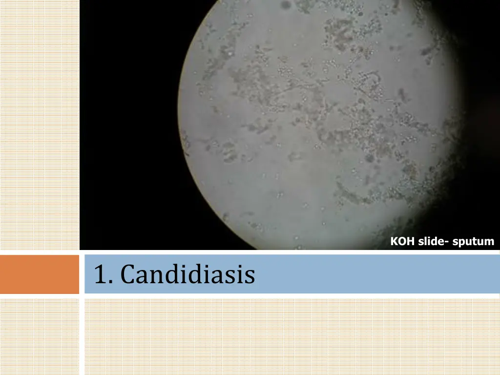 koh slide sputum