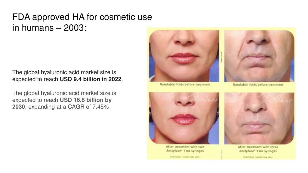 fda approved ha for cosmetic use in humans 2003