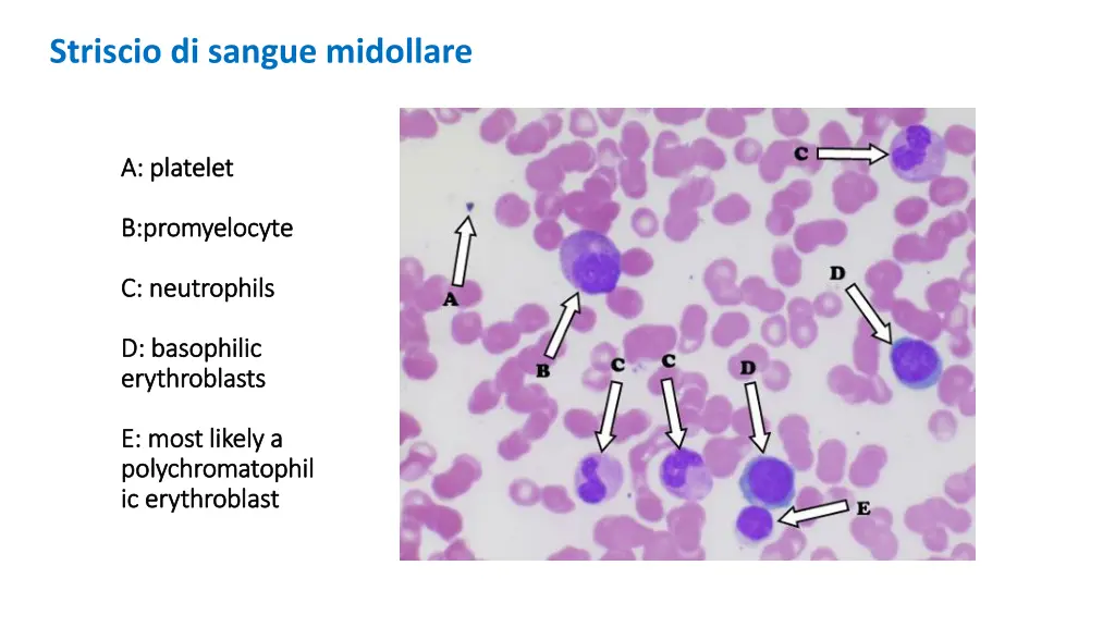 striscio di sangue midollare