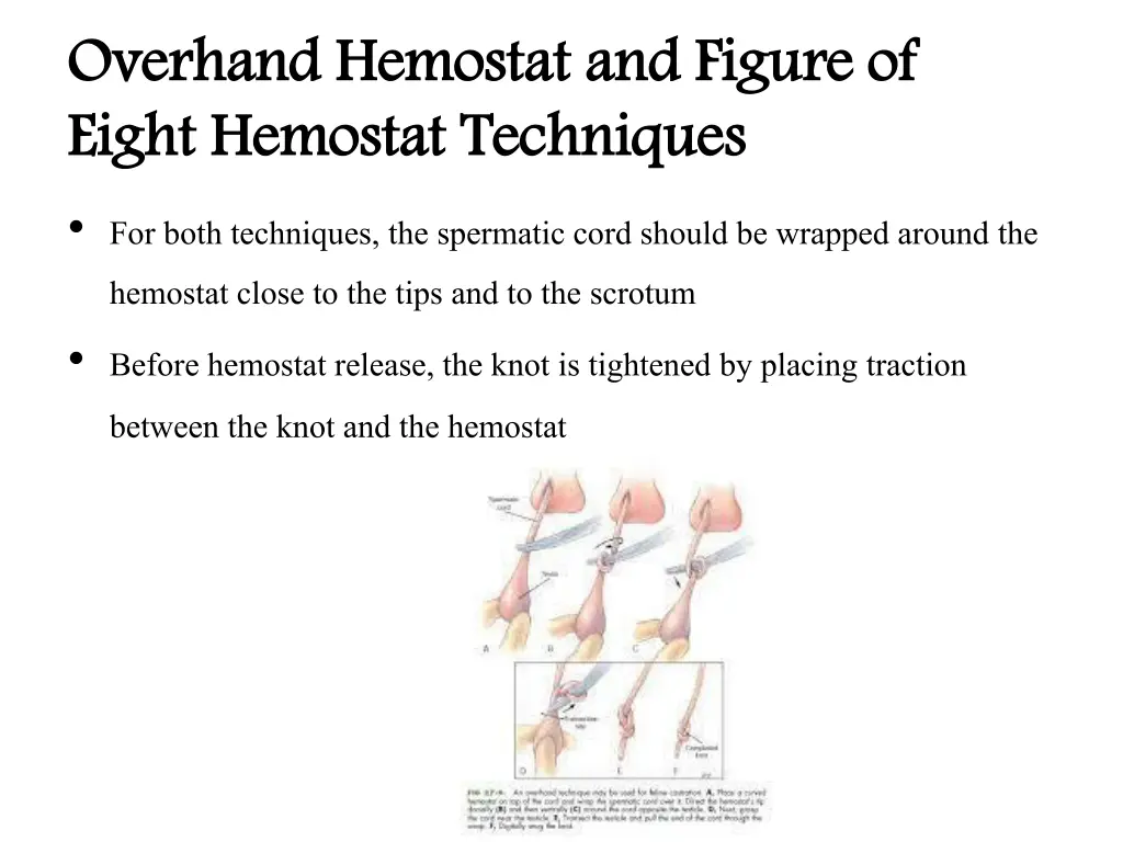 overhand hemostat and figure of eight hemostat