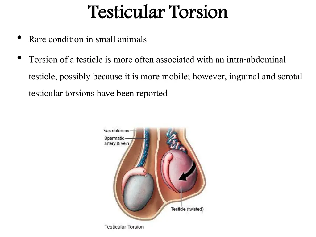 testicular torsion