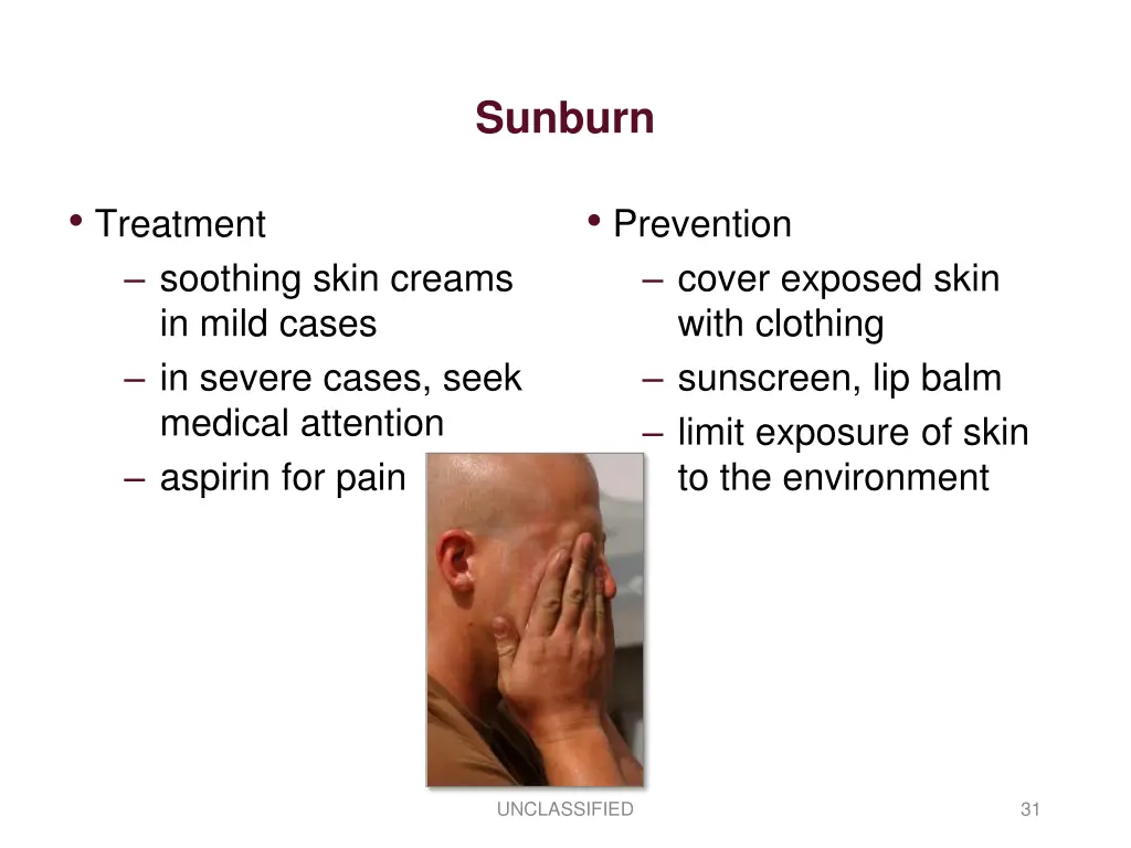 sunburn 1