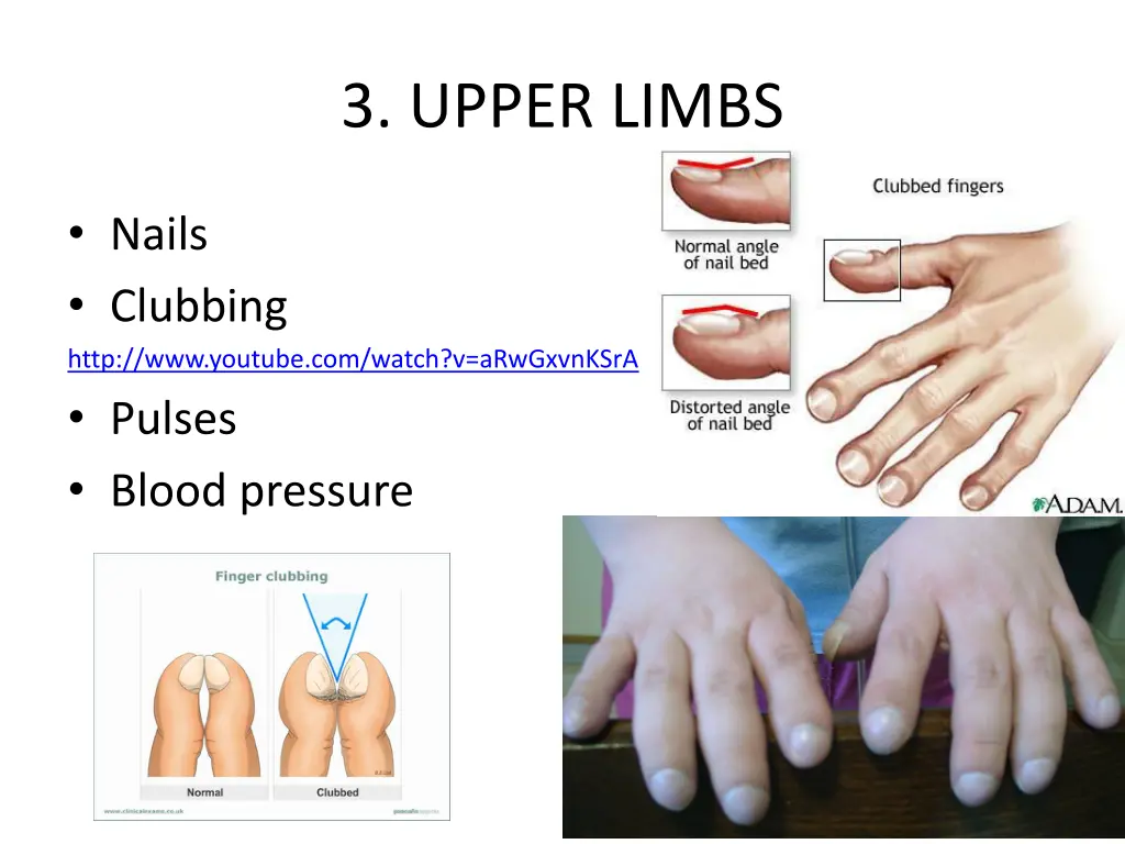 3 upper limbs