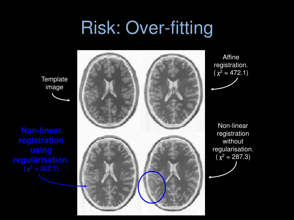 risk over fitting 1