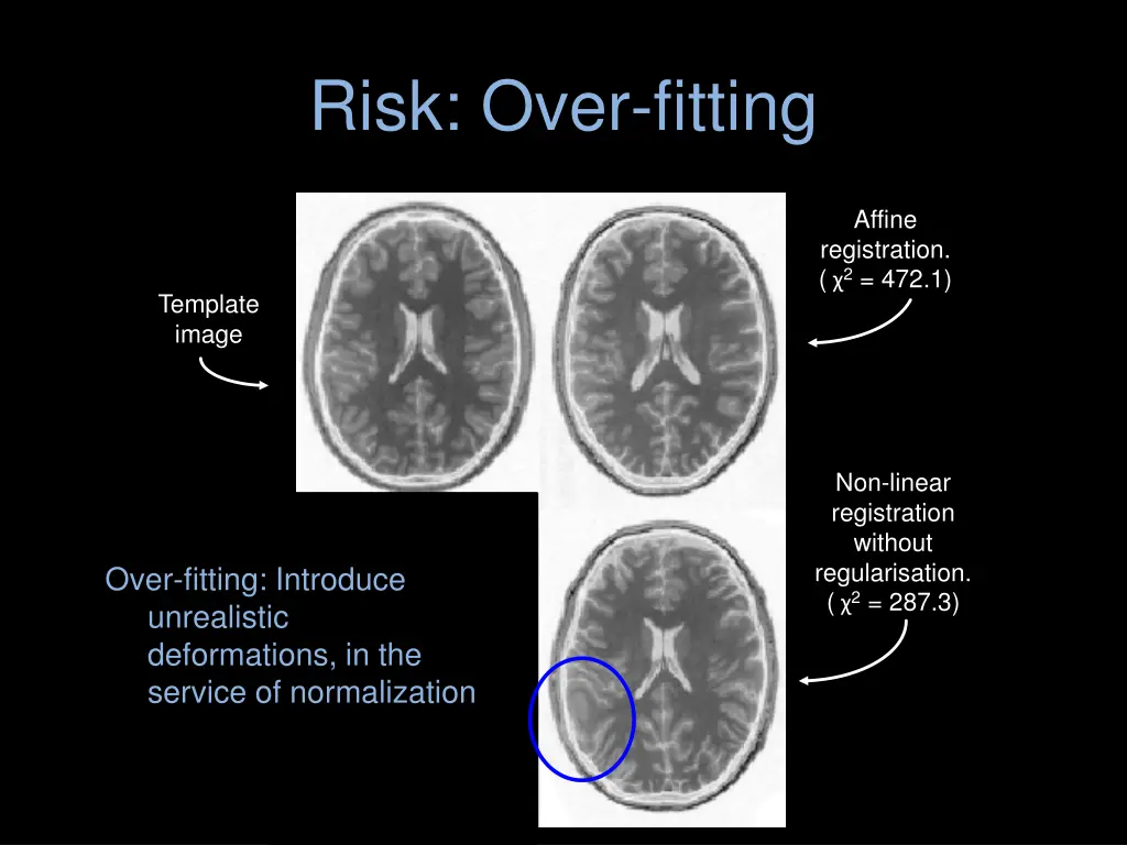 risk over fitting