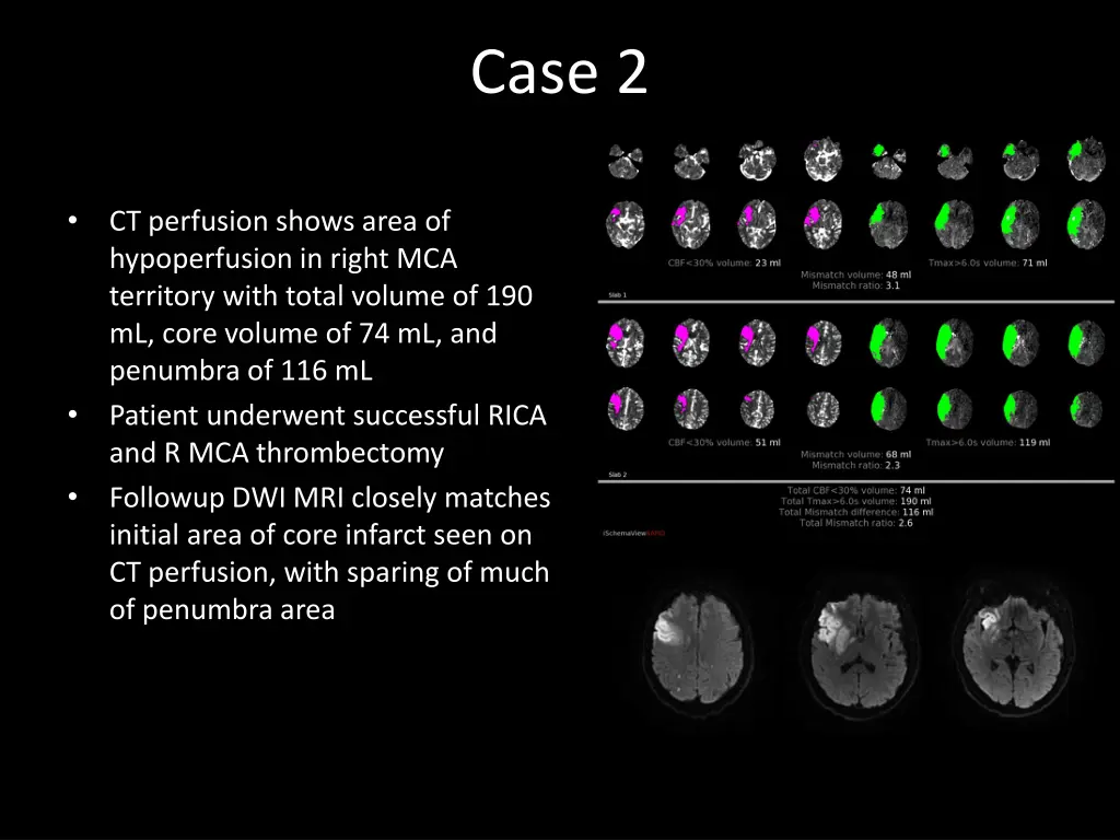 case 2