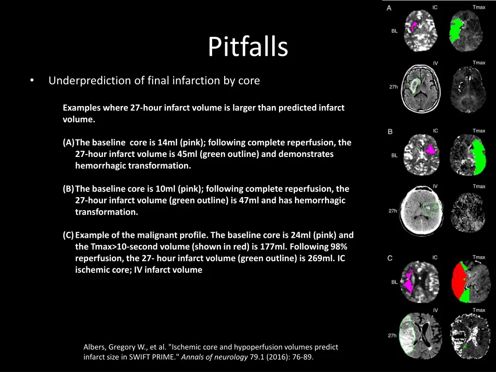 pitfalls