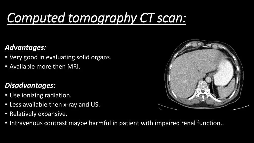 computed tomography ct scan computed tomography