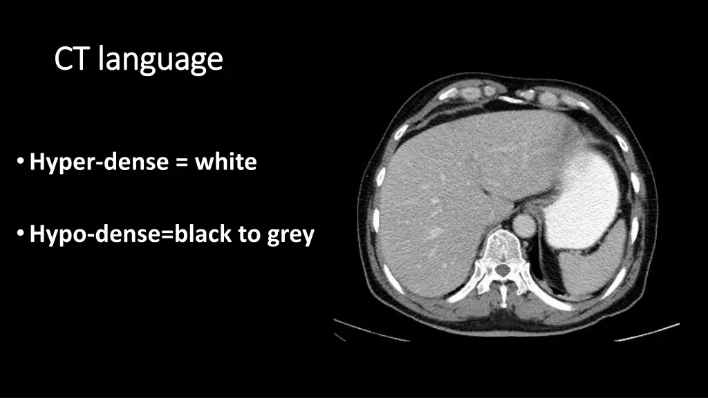 ct language ct language