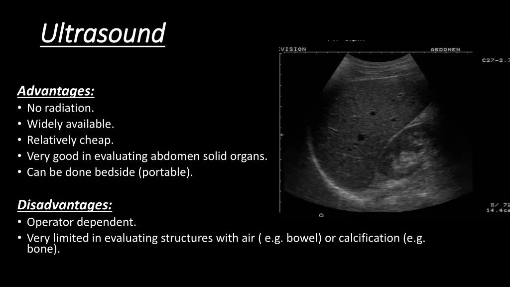 ultrasound ultrasound