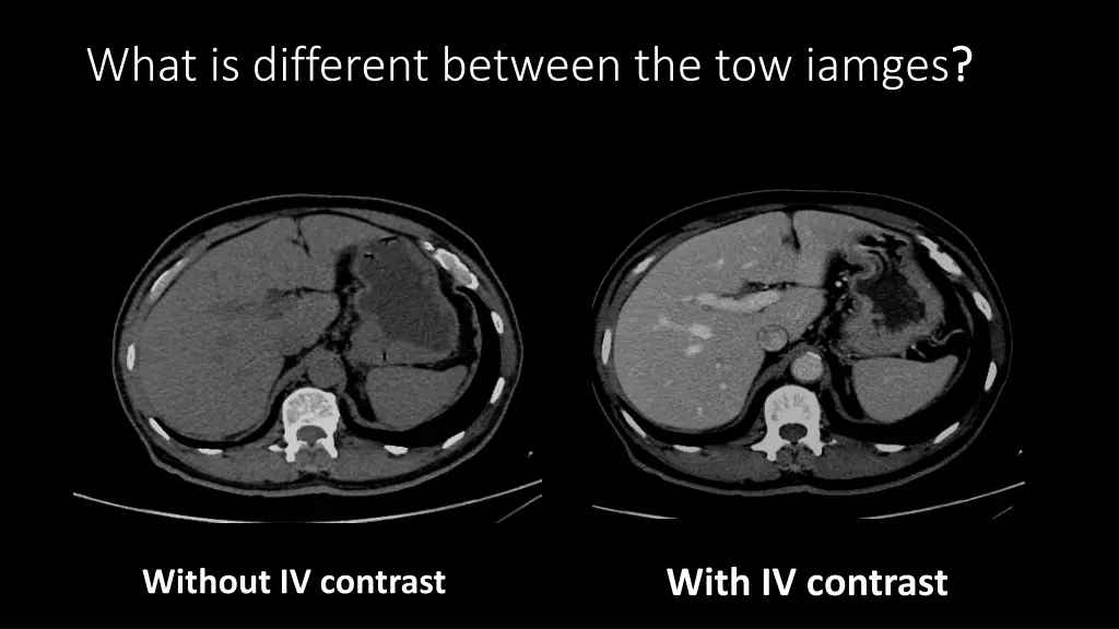 what is different between the tow iamges 1