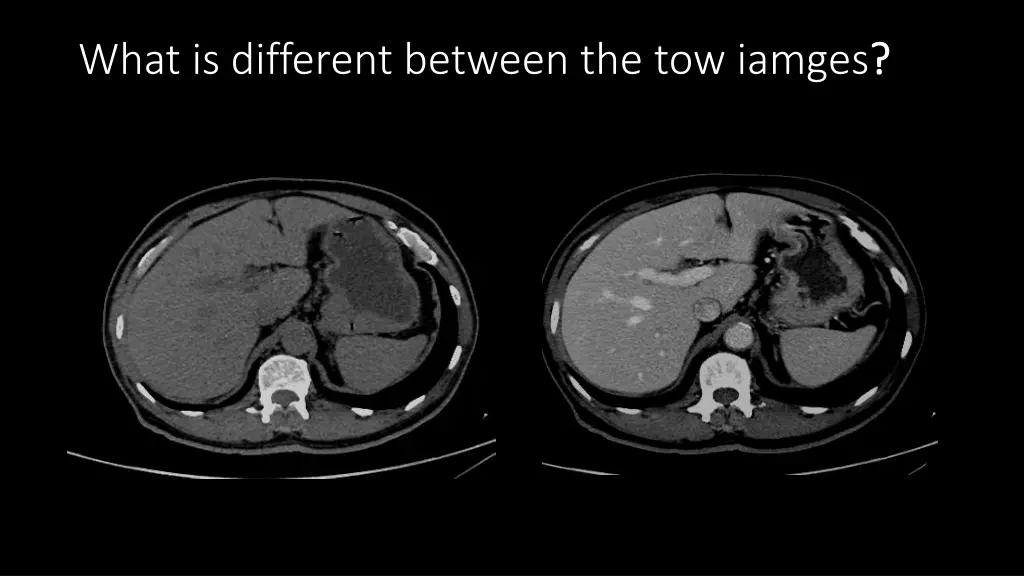 what is different between the tow iamges