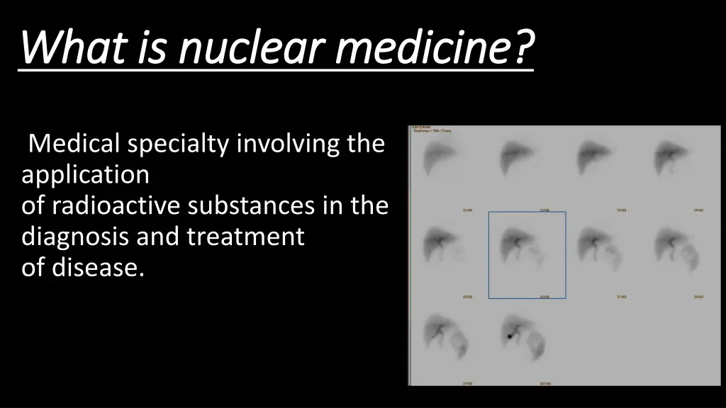 what is nuclear medicine what is nuclear medicine