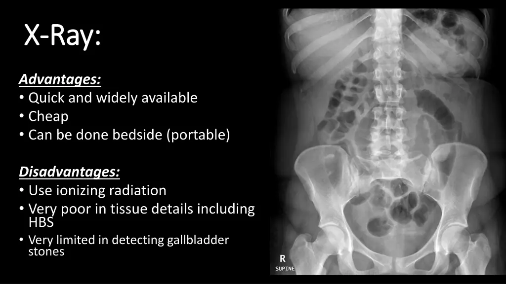 x x ray ray