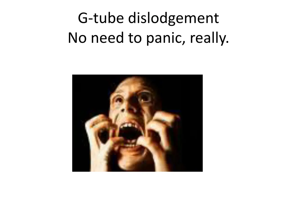 g tube dislodgement no need to panic really